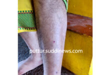 ಪುತ್ತೂರು ದೇವಳದ ಬಳಿ ಅರ್ಚಕರಿಗೆ ನಾಯಿ ಕಡಿತ